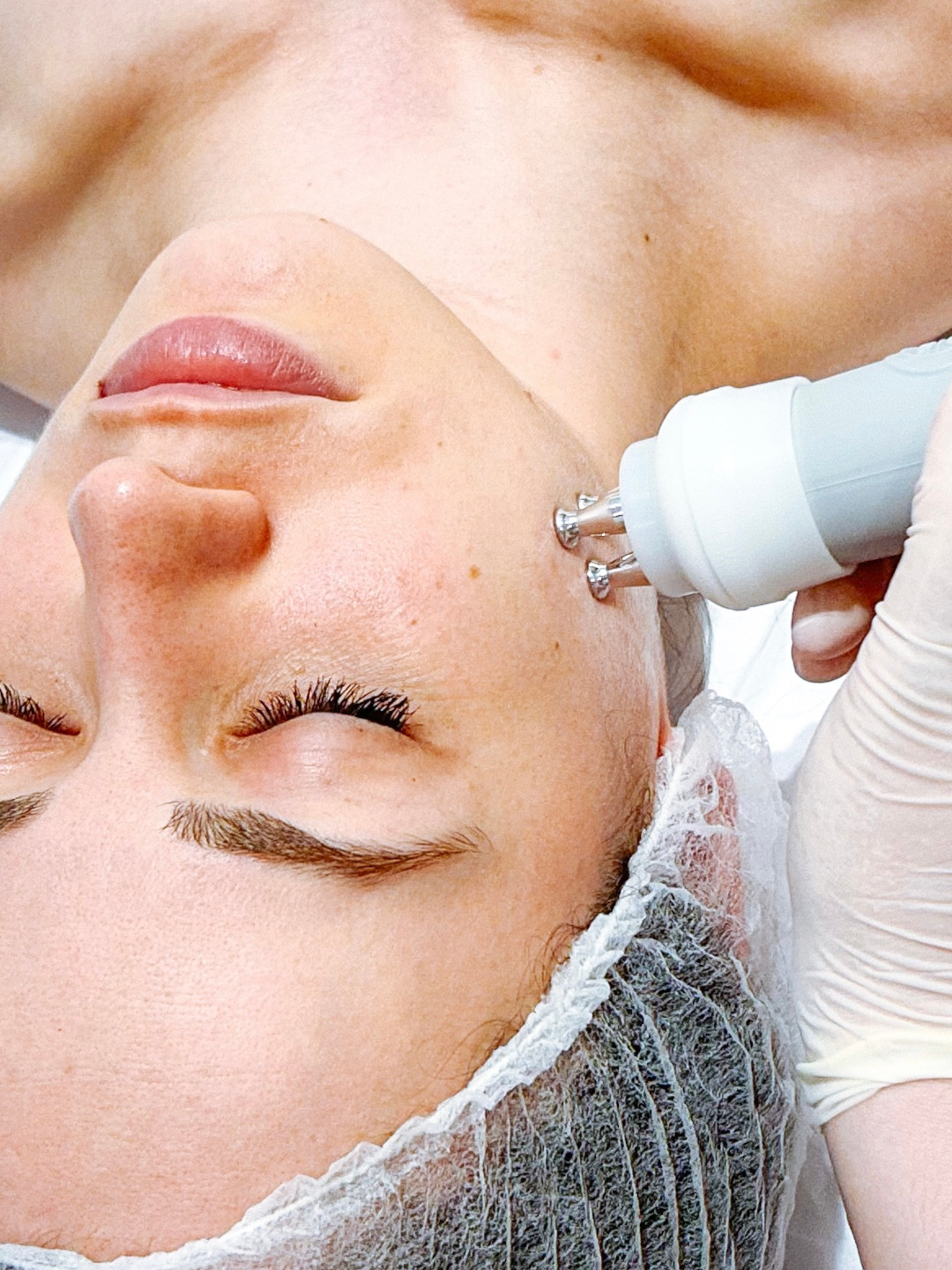 Radiofrequência Facial Radiofrequência Facial